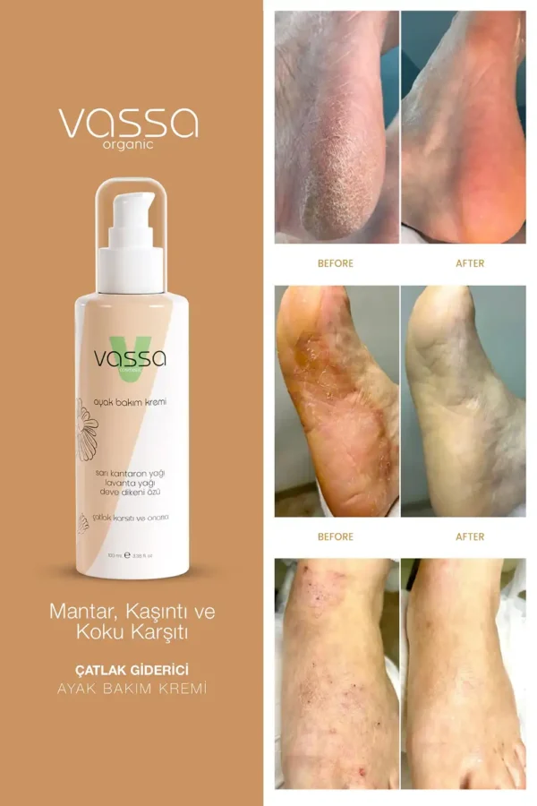 Diyabetik Ayak Bakım Kremi